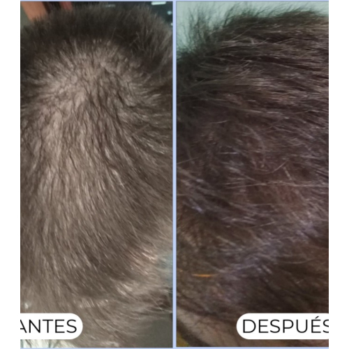 Alma Secret - Shampoo purificante Shikakai per capelli normali o grassi