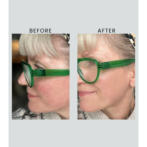 Altruist - Crema da giorno Dermatologist Anti-Redness & Pigmentation Light SPF50