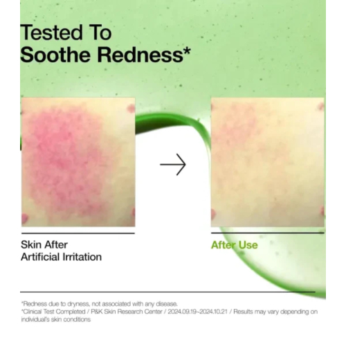 Anua - Siero anti-acne con acido azelaico 10+ e acido ialuronico