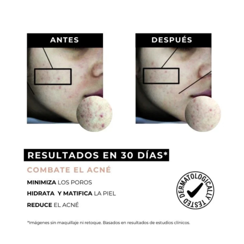 Arganour - Crema antiacne riducente per le macchie  Equilibrium - Pelle grassa a tendenza acneica