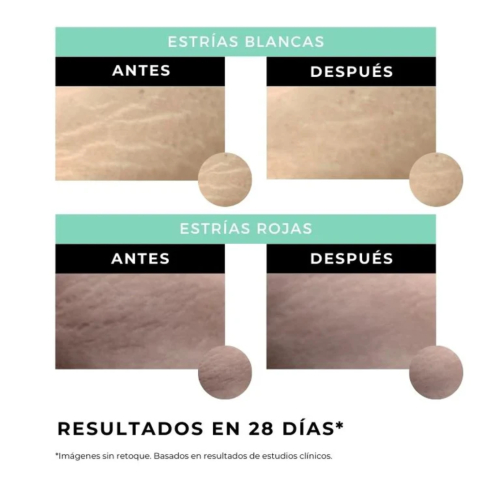 Arganour - Crema corpo anti-smagliature