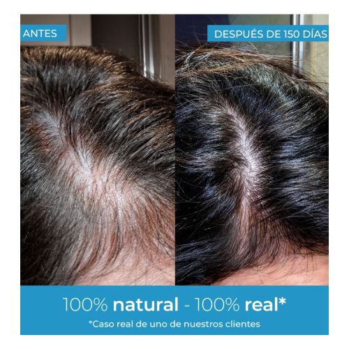 Arganour - Siero rinforzante per capelli Strength