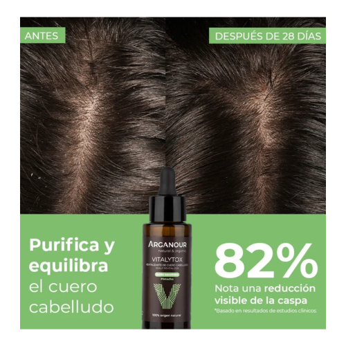 Arganour - Trattamento rivitalizzante per il cuoio capelluto Vitalytox