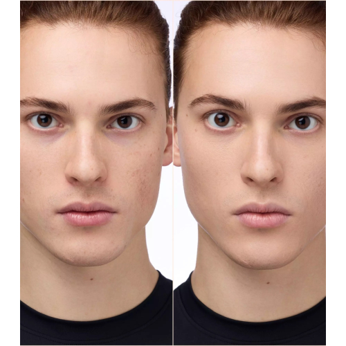 Catrice - Correttore Instant Bright - 032N