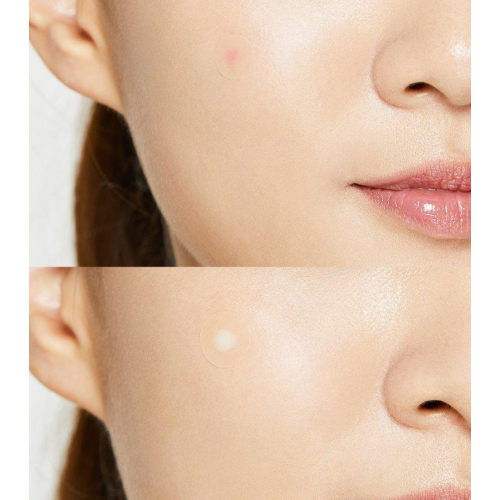 COSRX - Patch per imperfezioni Acne Pimple Master Patch