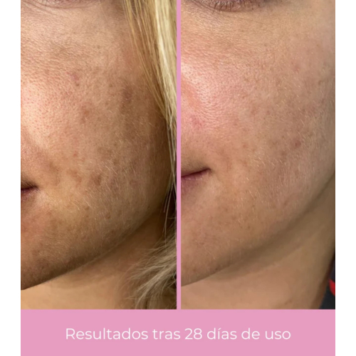 CR Cosmetics - *Clarifying* - Crema viso depigmentante