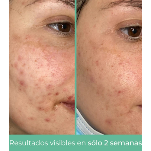 CR Cosmetics - *Purifying* - Crema viso seboregolatrice