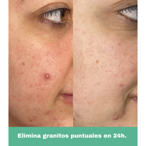 CR Cosmetics - *Purifying* - Roll-on anti-imperfezioni