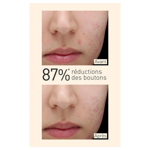 Embryolisse - Siero opacizzante per pelli miste e grasse con estratto di curcuma