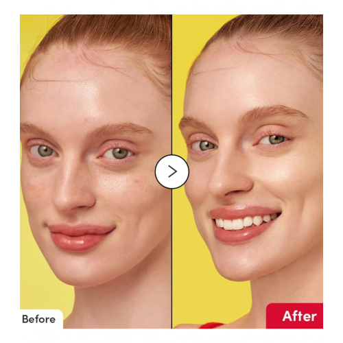 Eqqualberry - Siero viso illuminante Vitamin