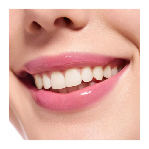 essence - Lucidalabbra volumizzante Extreme Shine - 21: Pretty in Pink