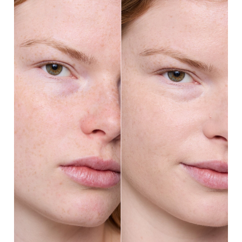 essence - Prebase in siero - Pore Refining