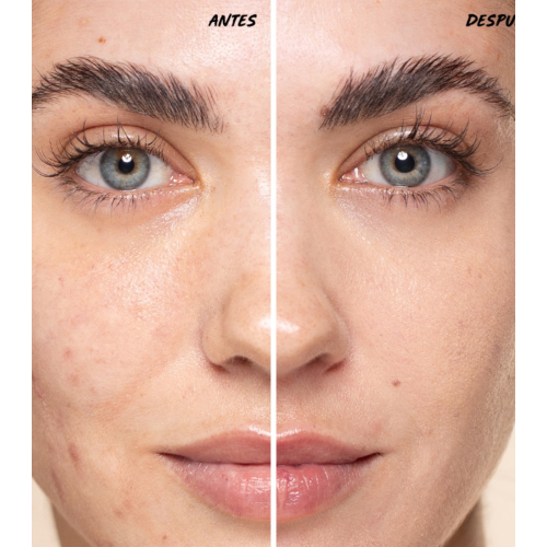 Freshly Cosmetics - Correttore multiuso Vitamin Fix - 300 Apricot Nectar