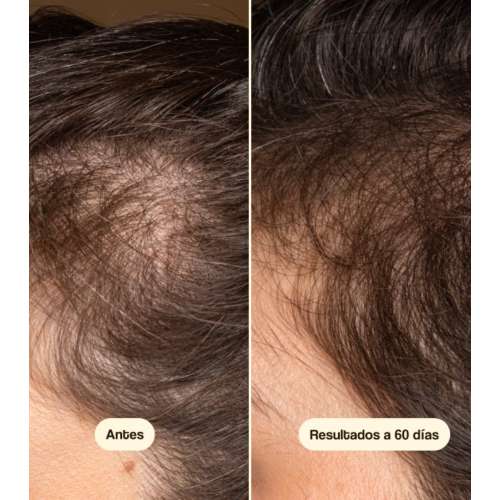 Freshly Cosmetics - Trattamento anticaduta Hair Growth & Density