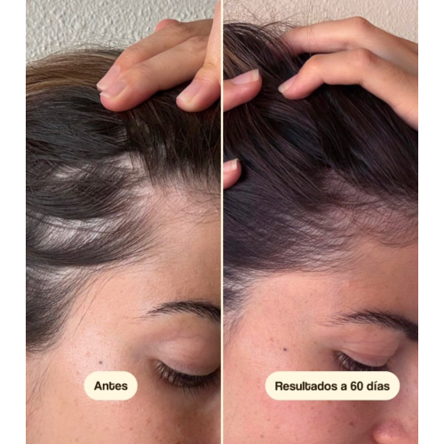 Freshly Cosmetics - Trattamento anticaduta Hair Growth & Density