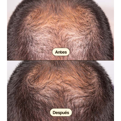 Freshly Cosmetics - Trattamento anticaduta Hair Growth & Density