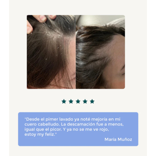 Green Cornerss - Shampoo ai piselli - Cuoio capelluto sensibile