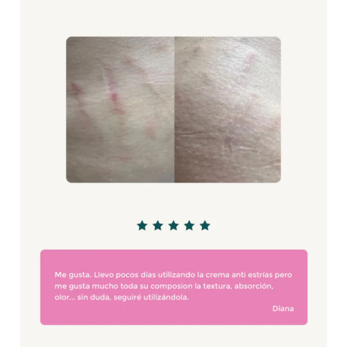 Green Cornerss - Crema anti-smagliature al Sangue di Drago