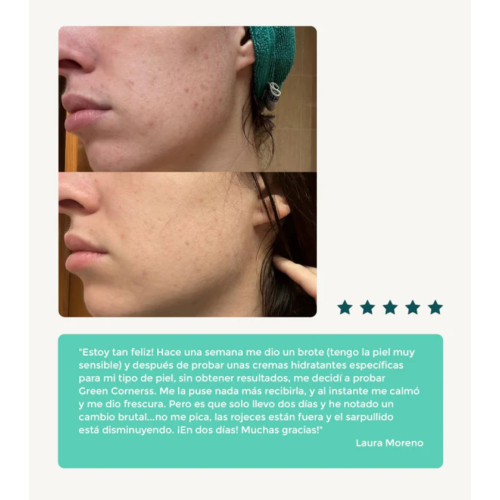 Green Cornerss - Crema viso idratante al cavolo - Pelle atopica