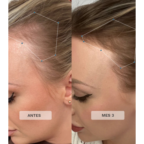 Hairburst - Vitamine per capelli Advance + Premium