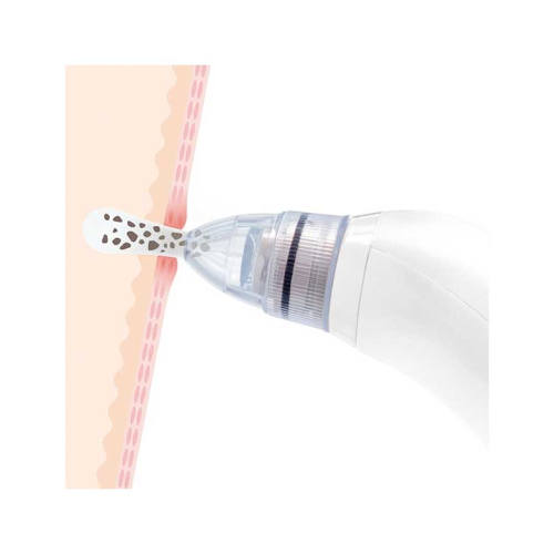 InnovaGoods - Detergente viso elettrico per punti neri Pore·Off