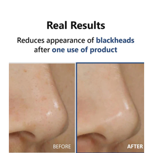 ISNtree - *Mugwort* - Siero tonico serale Hyper Acid 4 AHA BHA PHA LHA 30