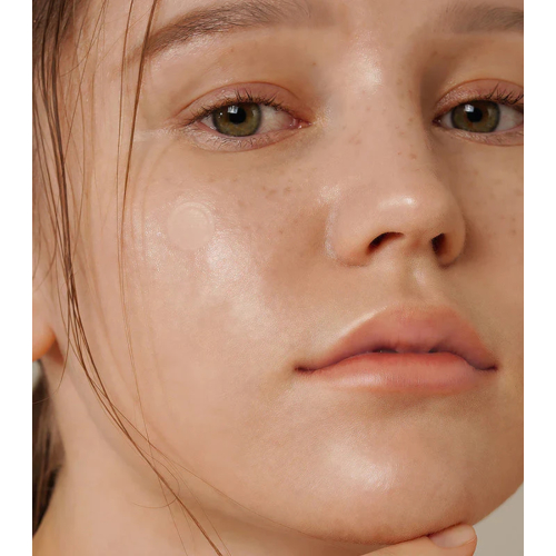 ISNtree - Cerotti anti-imperfezioni Onion Newpair Basic - 24 unità