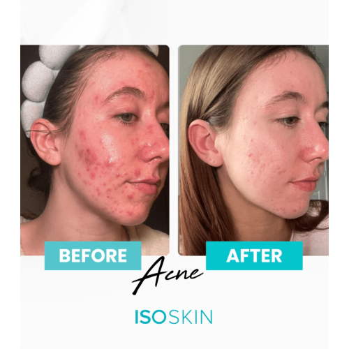 ISOCLEAN - *ISOSKIN* - Spray viso e corpo Hypochlorous - 100ml