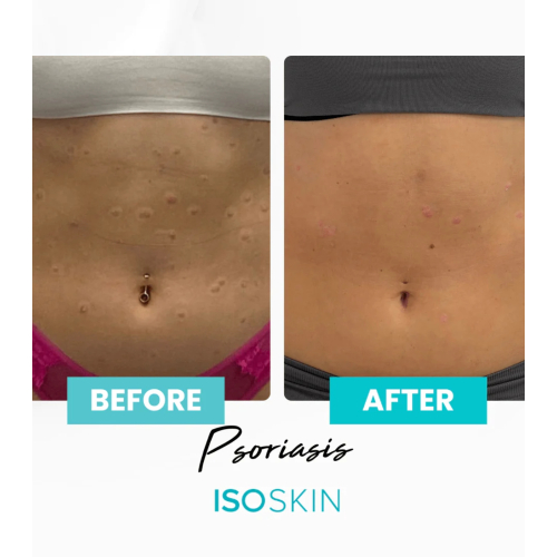 ISOCLEAN - *ISOSKIN* - Spray viso e corpo Hypochlorous - 100ml