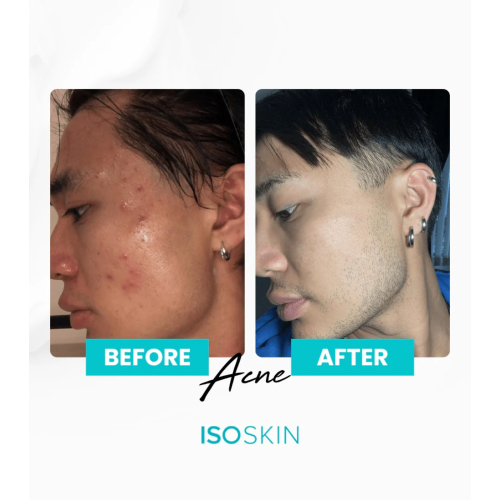 ISOCLEAN - *ISOSKIN* - Spray viso e corpo Hypochlorous - 100ml