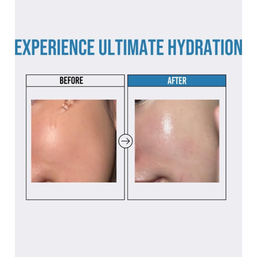 Jumiso - *Waterfull* - Siero viso idratante Hyaluronic Acid