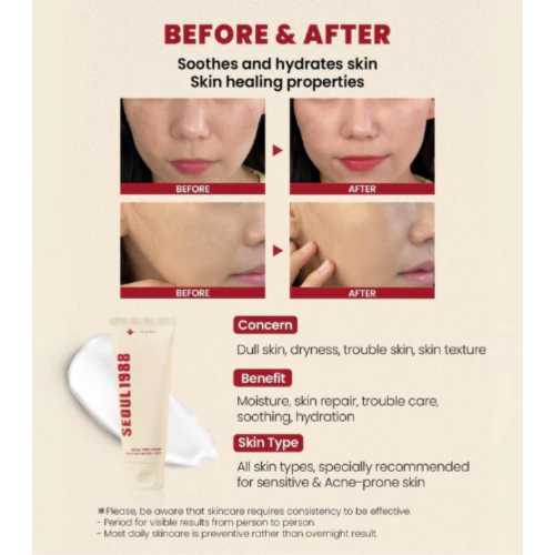 K-Secret - *Seoul 1988* - Crema viso Snail Mucin 93% + Rice