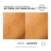 Loreal Paris - *Bright Reveal* - Peeling esfoliante anti-macchie ad azione rapida - Segni post-acne e macchie scure