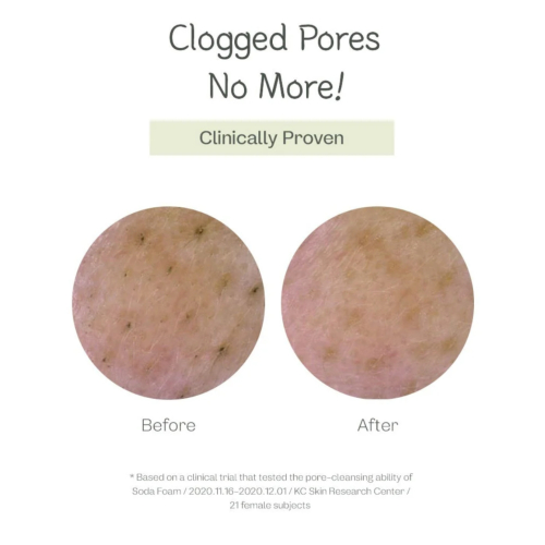 ma:nyo - Detergente viso Deep Pore Cleansing Soda Foam