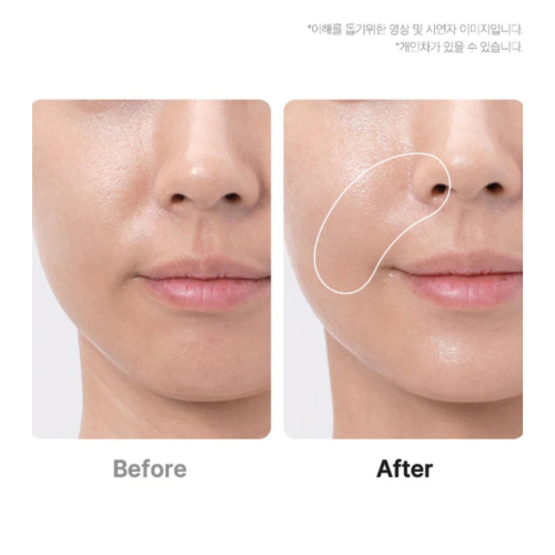 Medicube - *Age-R* - Dispositivo avanzato per la cura del viso Booster Pro Ex