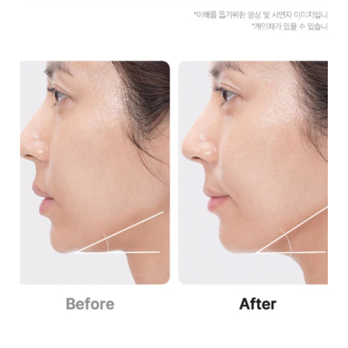 Medicube - *Age-R* - Dispositivo avanzato per la cura del viso Booster Pro Ex - Pink