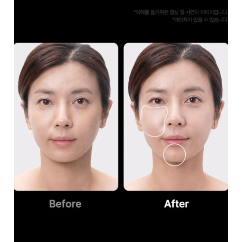 Medicube - *Age-R* - Dispositivo avanzato per la cura del viso Booster Pro Ex - Pink