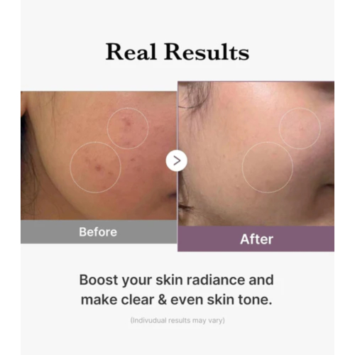 Medicube - *Age-R* - Tonico idratante Glutathione Glow Toner