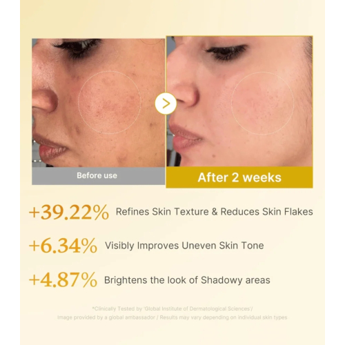 Medicube - *Kojic Acid* - Tonico viso esfoliante