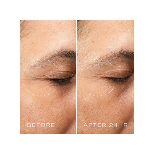 Medik8 - *Crystal Retinal* - Crema contorno occhi antietà con Retinal e Vitamina A Ceramide Eye 6