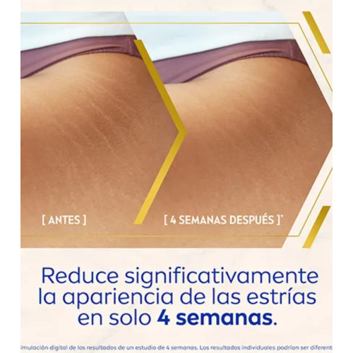 Nivea - Siero corpo trattamento avanzato antismagliature e anti-imperfezioni Luminous 630