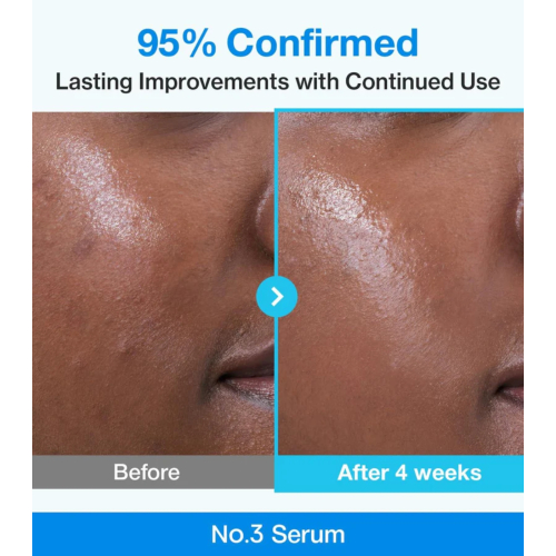 Numbuzin - Siero minimizzante per i pori No.3 Blue Bio-Retinol
