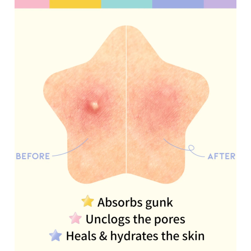 OOTD Beauty - Cerotto a forma di stella Star Spot Patch