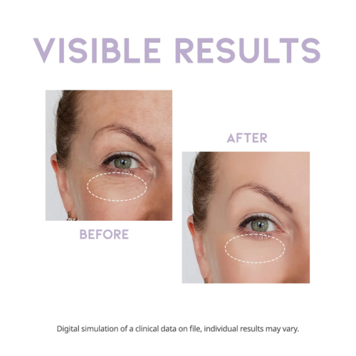 OOTD Beauty - Siero per gli occhi notturno