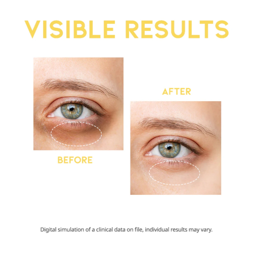 OOTD Beauty - Siero illuminante per gli occhi Dark Circle