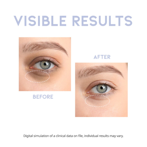 OOTD Beauty - Siero contorno occhi rivitalizzante Intensive Serum