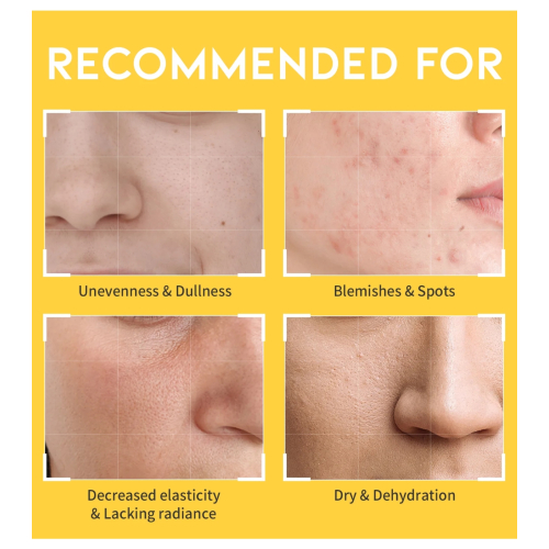 OOTD Beauty - Dark Spot Vitamin C Tonico illuminante