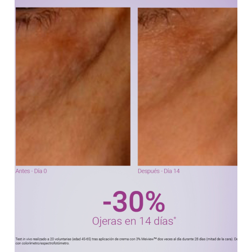 Primaderm - Contorno occhi antirughe Xpert Expression Contour
