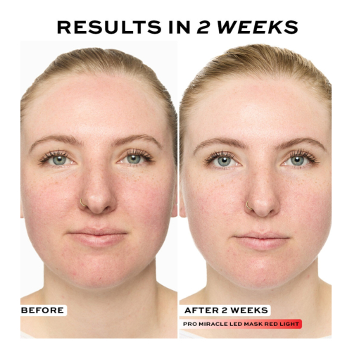 Revolution Pro - Maschera per il viso Miracle LED Face Mask
