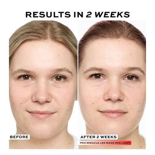 Revolution Pro - Maschera per il viso Miracle LED Face Mask